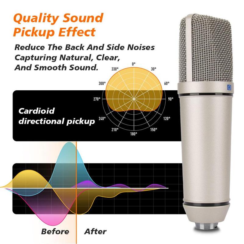 U87 Vocal Condenser Microphone, 1 Set Desktop Suspended Microphone with Mic Base & Mic Cable, Professional Microphone for Live Recording & Vocal Music Studio